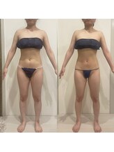 シュエットプラス(Chouette+)/痩せてる人もより細く！