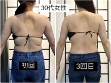 リメイクボディ センダイ(Re.Make Body SENDAI)/ブライダルにも人気メニュー♪