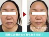 筋膜リリースのたるみ・しわ改善コース（60分）