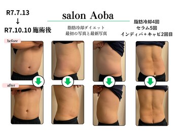 サロンアオバ 稲毛店(salon Aoba)/30代男性のビフォーアフター