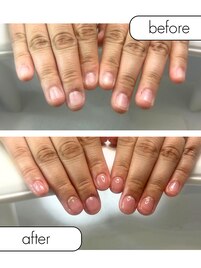 ◆深爪矯正+定額デザイン◆