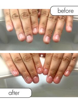 ピノ(pino)/◆深爪矯正+定額デザイン◆