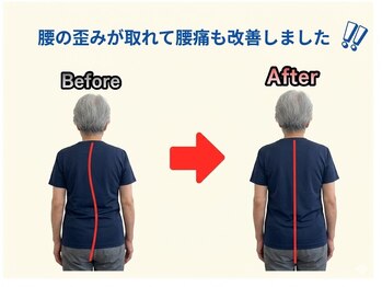 のなか整体院/整体 Before→After