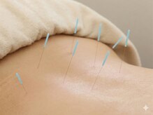 丸太町骨盤整骨院 鍼灸院/ぎっくりに