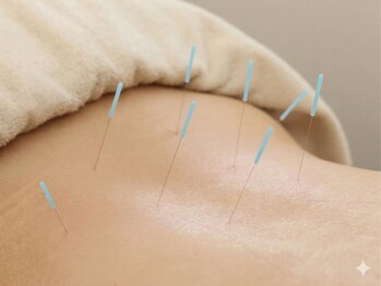 丸太町骨盤整骨院 鍼灸院/ぎっくりに