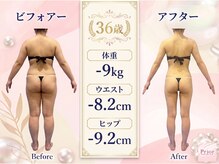 プリオール 高崎花水木店(Prior)の雰囲気(-9キロ達成! 頑張った分だけご褒美付の脂肪買取コース。)