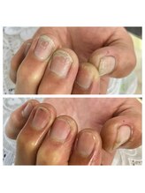 ネイルサロン ヴィヴィ(nail salon ViVi)/メンズコース