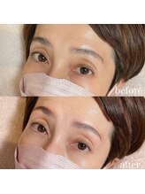 ダリ(Dali)/ハリウッドブロウリフト