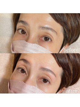 ダリ(Dali)/ハリウッドブロウリフト