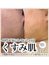 エリス(ELISSE)/くすみ肌のお悩み