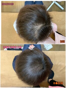 大門鍼灸整骨院/髪の毛のあらゆるお悩みに対応！