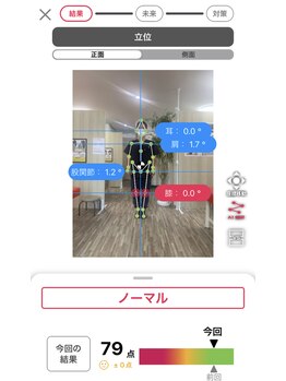 ナオル整体 浦添院(NAORU整体)/AI姿勢診断【正面】