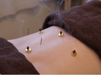 繁内鍼灸治療院/お灸