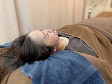 こじま 富雄団地接骨院/ヒト幹細胞美容鍼