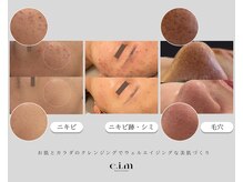 エイム(e.i.m)