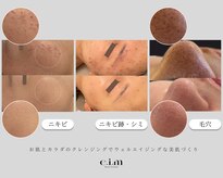 エイム(e.i.m)