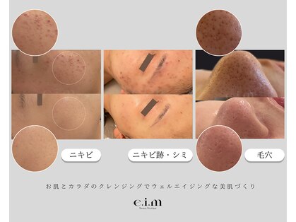 エイム(e.i.m)の写真