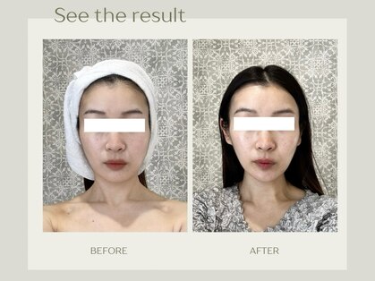 アップライン(Up Line)の写真