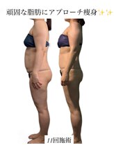 痩身革命 大宮店/筋膜リリース/リンパ/ダイエット