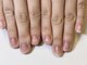 シュシュネイル(chou chou NAIL)の写真/割れ爪、深爪、薄い爪など自爪にお悩みがある方に◎豊富な知識で自爪の健康を保った施術を心掛けています☆