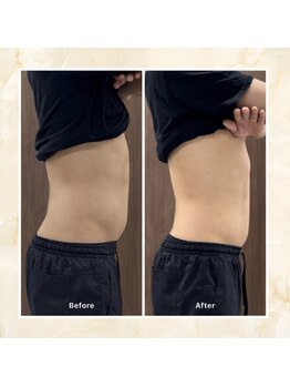 プレメ 人形町院(The Preme)/腰痛/反り腰メンテナンス