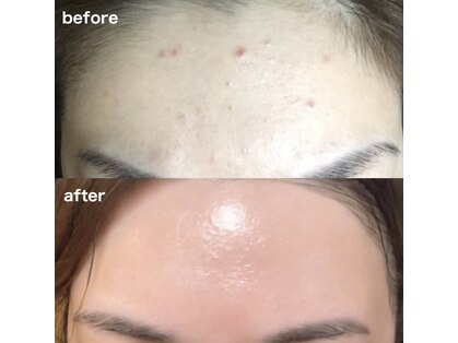 アンテイン チル(anthein chill)の写真