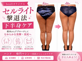 ビオール 新宿店(beall)の写真/最新美容機器「キャビテーション」徹底アプローチ◎頑固な太ももの脂肪にもう悩まない♪お得なクーポン多数