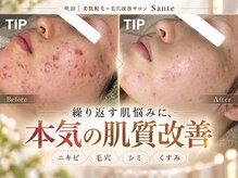 サンテ(Sante)