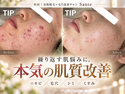 サンテ(Sante)の写真