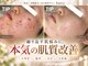 サンテ(Sante)の写真