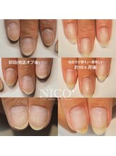ニコプラス(NICO+)/自爪育成パラジェルクリア補強