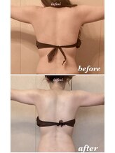 アンフィニ(infini)/短期集中コース全身5回（2ヶ月）