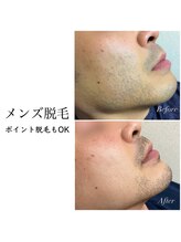 オシャレハウスシルバ(OshareHausuSILVA)/メンズもOK