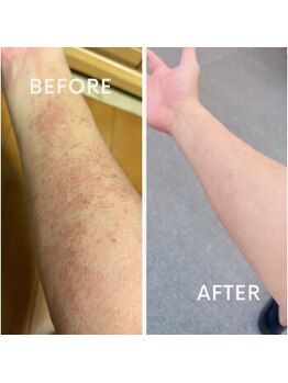 上尾ひかり整骨院/腸活で体調を良く!