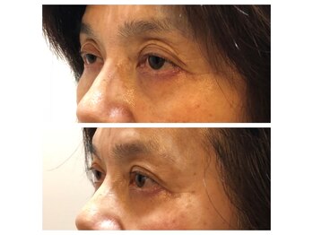 ロックスペーストーキョー(Rock Space Tokyo)/インディバ痩身/九段下/銀座