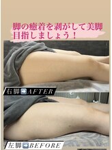 メローワックス 宮崎店(MELLOW WAX)/チノザメソッド美骨矯正痩身