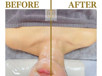 ヴェールブランシュ 町田(Vert Blanche)/#ブライダルエステ#痩身#鎖骨