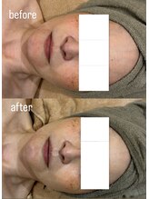 ムゥ(muu)/【フェイシャルマッサージ】