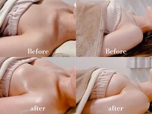 ローズルート(Rose route)/←20代前半 →30代前半 バスト