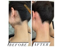 エピリア(Epilear)