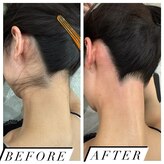 エピリア(Epilear)