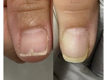 ととりえ/ビフォーアフター