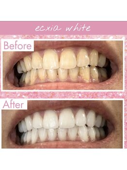 エクシアホワイト 北24条駅前店/