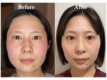 ウンジョルノ フェリーチェ 表参道店/お仕上げではカッサを