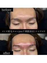 ユー 千葉駅前店(you)/ビフォ－アフター写真