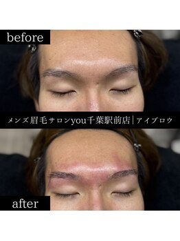 ユー 千葉駅前店(you)/ビフォ－アフター写真