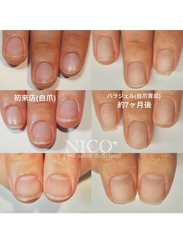 ニコプラス(NICO+)/自爪育成パラジェルクリア補強