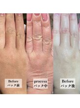 カラ(CARA)/年齢が出やすい手にもオススメ♪