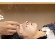 たくろう鍼灸院 豊田本院/【お灸】