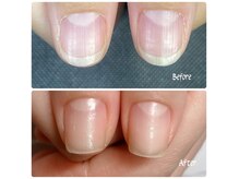 sicca nail